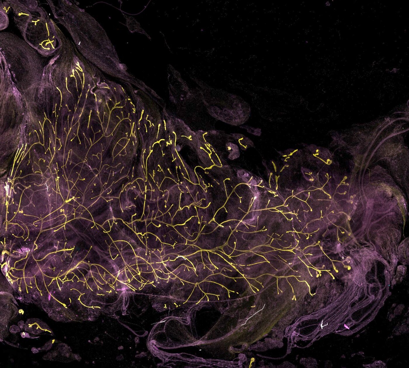 Human iPSC-Derived Mammary Gland Reconstitution in vivo