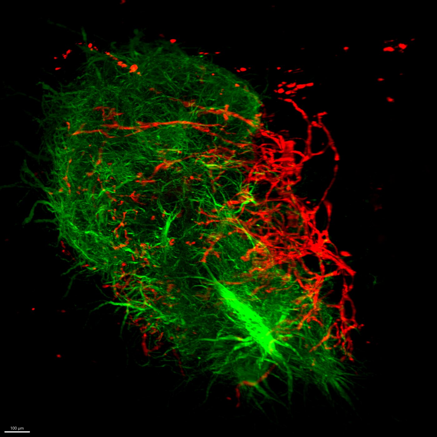 Vascularization of a brain organoid
