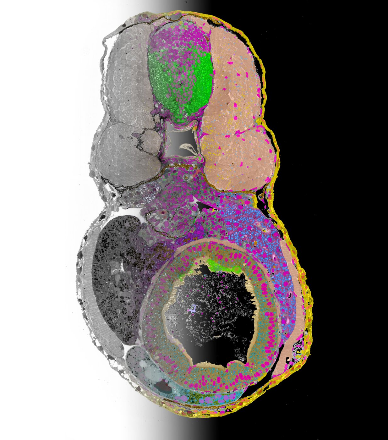 Zebrafish Embryo from TEM to AI